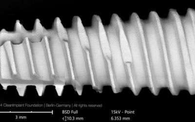 Dentis s-Clean SQ-SL — Overview