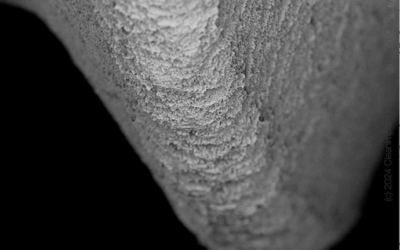 Dentis s-Clean SQ-SL — SEM