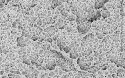Dentis s-Clean SQ-SL — SEM