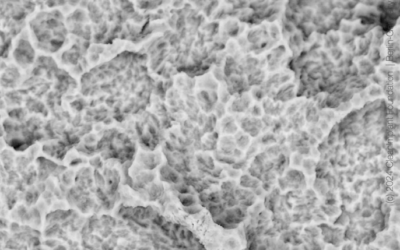 Dentis s-Clean SQ-SL — SEM