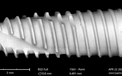 Izen Implant Zenex — Overview