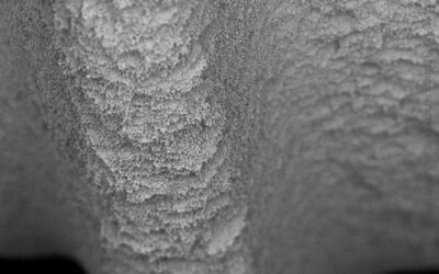 Izen Implant Zenex — Thread 500×
