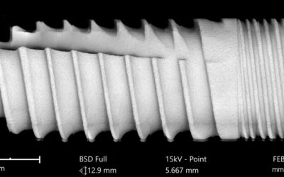 SLH DC Bone Level — Overview